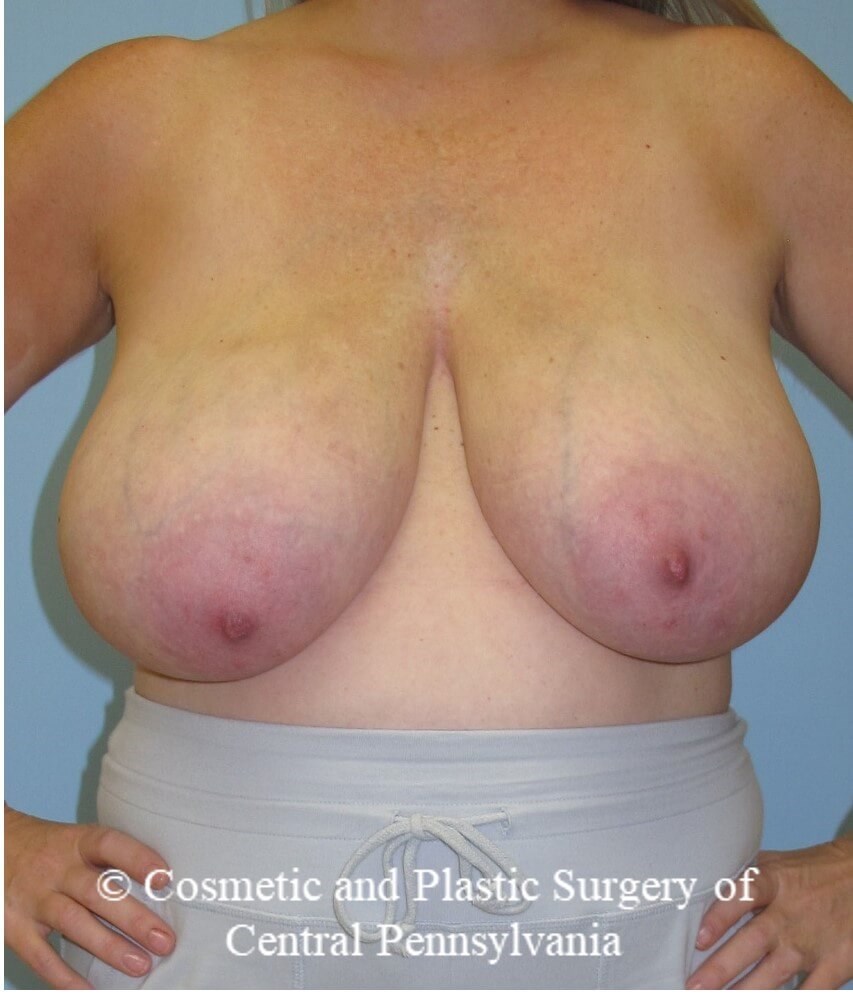 Before Image