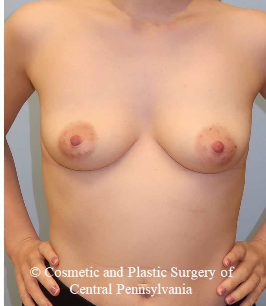Before Image