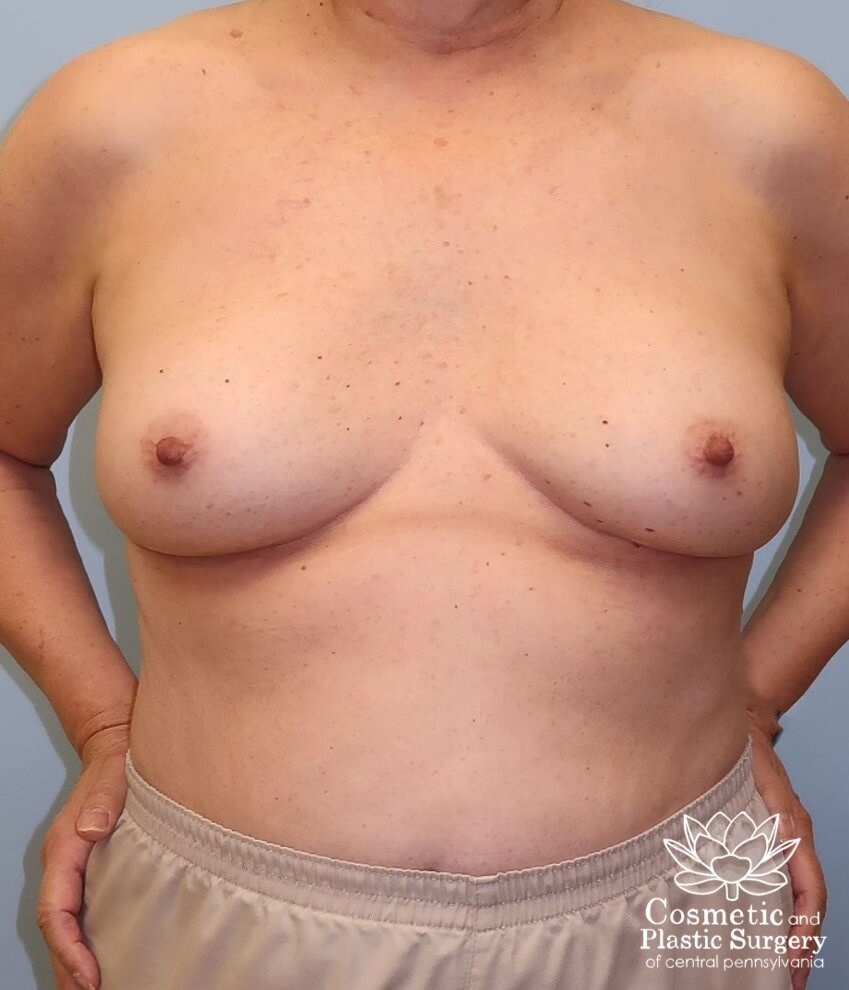Before Image
