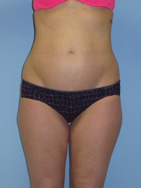 Before Image