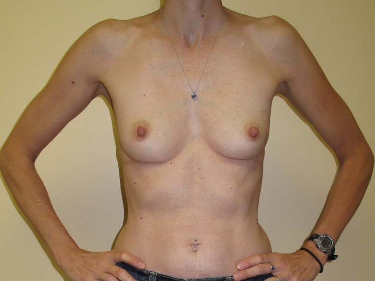 Before Image