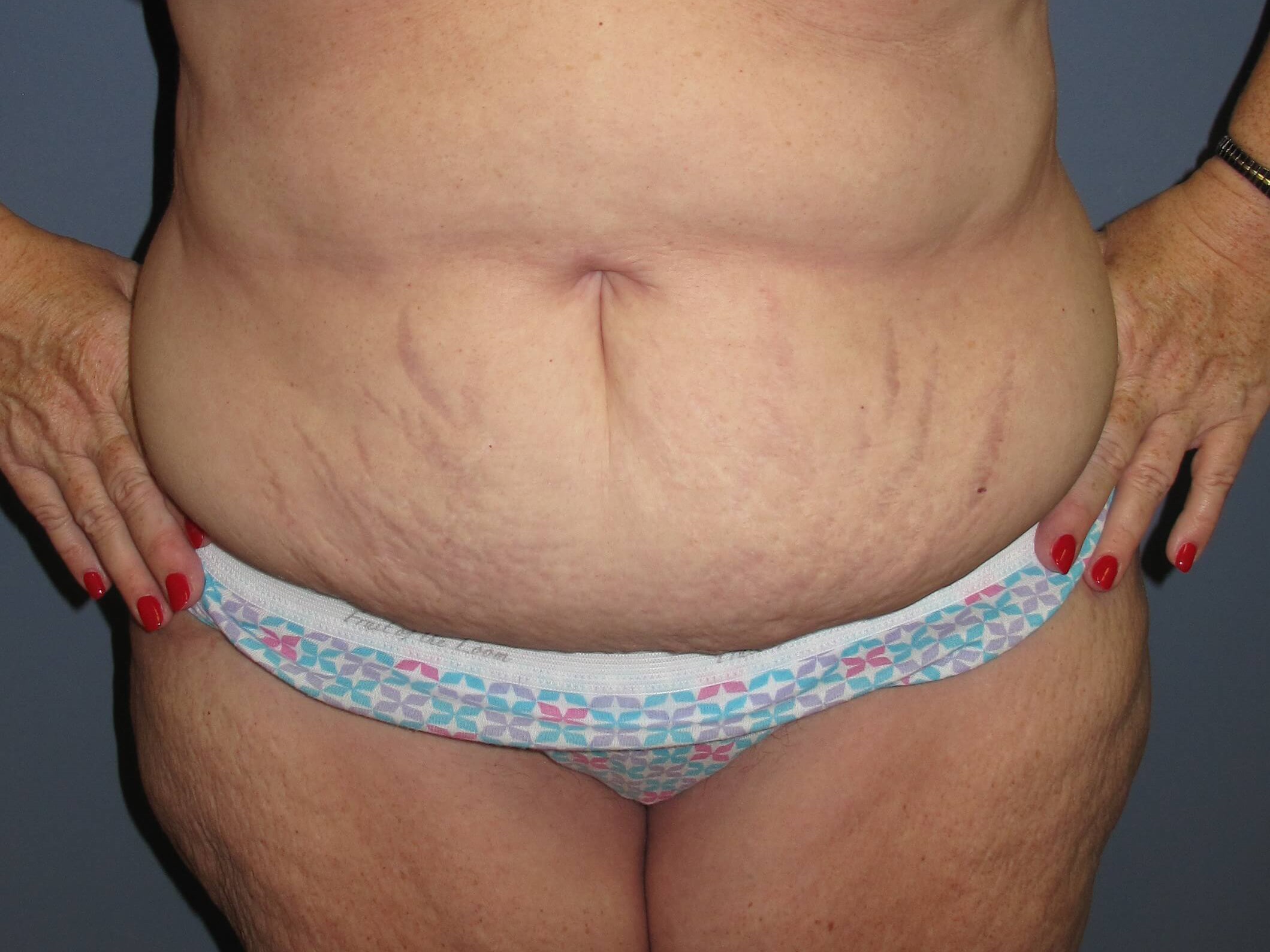 Before Image
