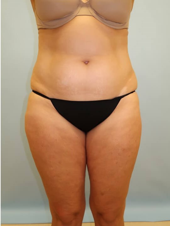 Before Image