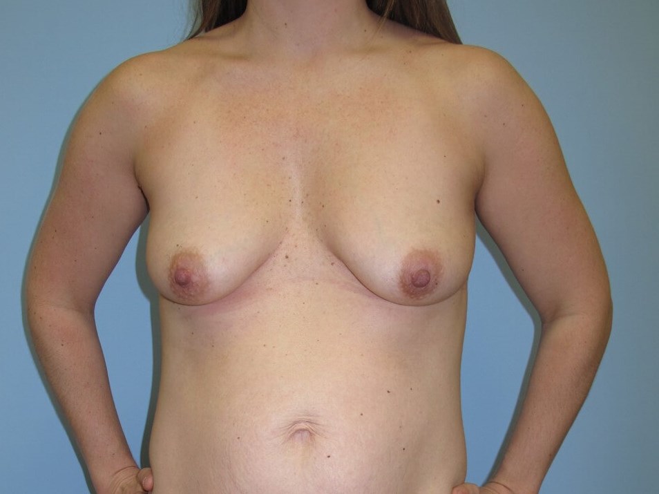 Before Image