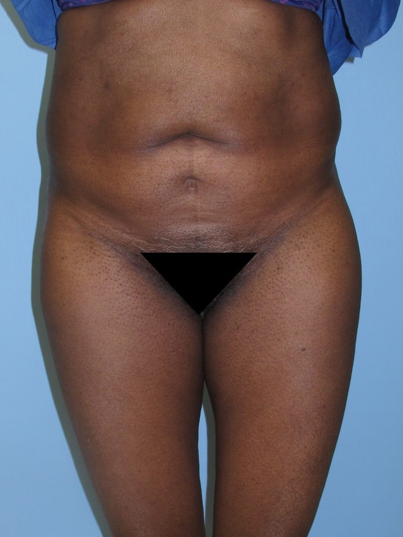 Before Image