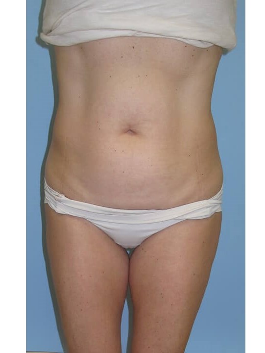 Before Image