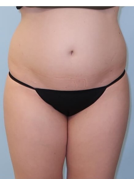 Before Image