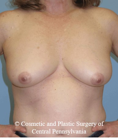 Before Image