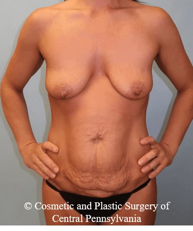 Before Image