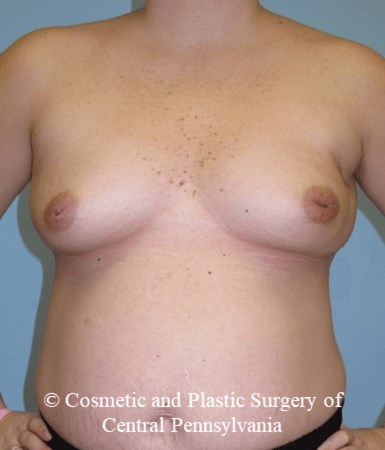 Before Image