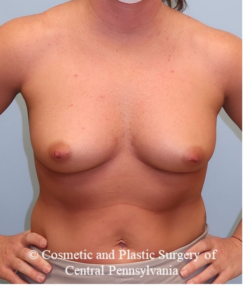 Before Image