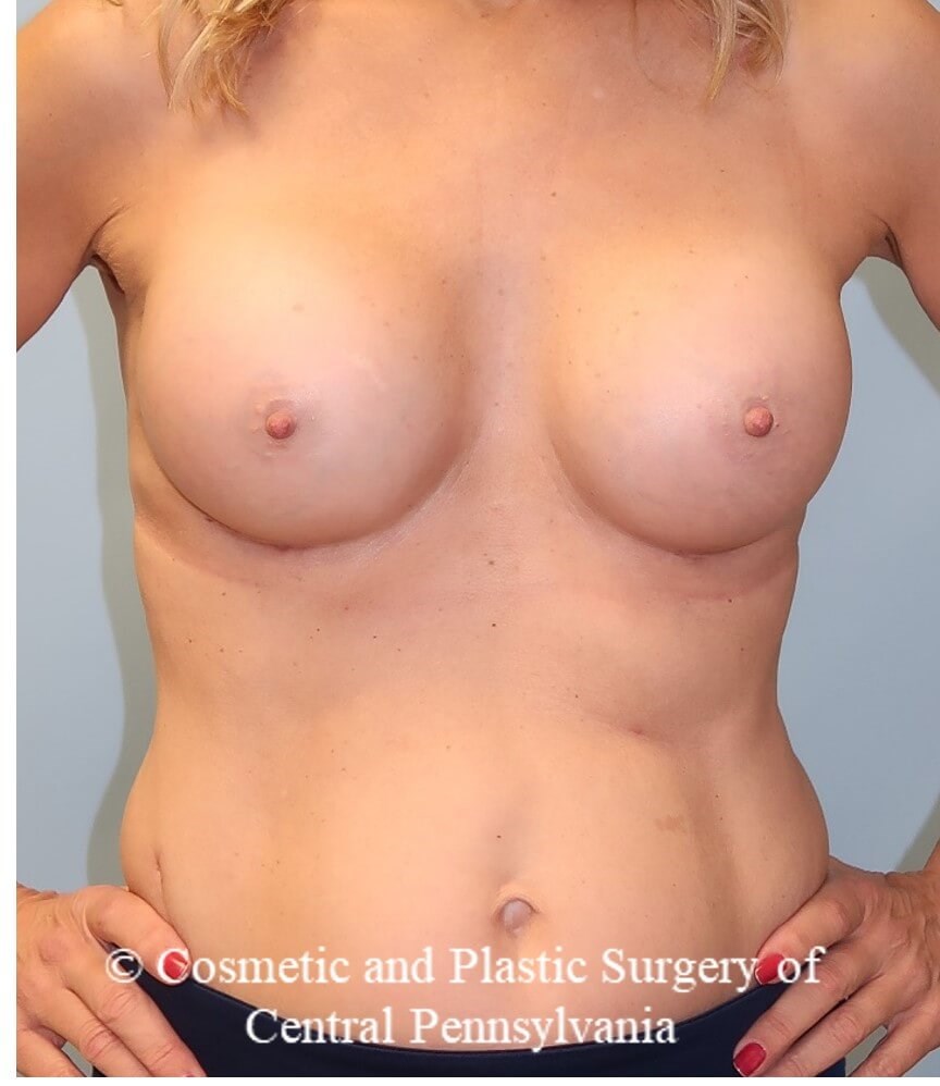 After Image