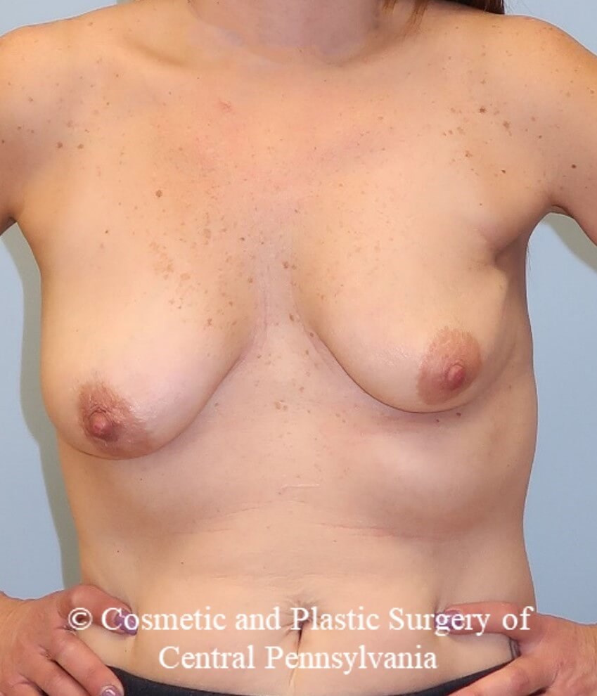 Before Image