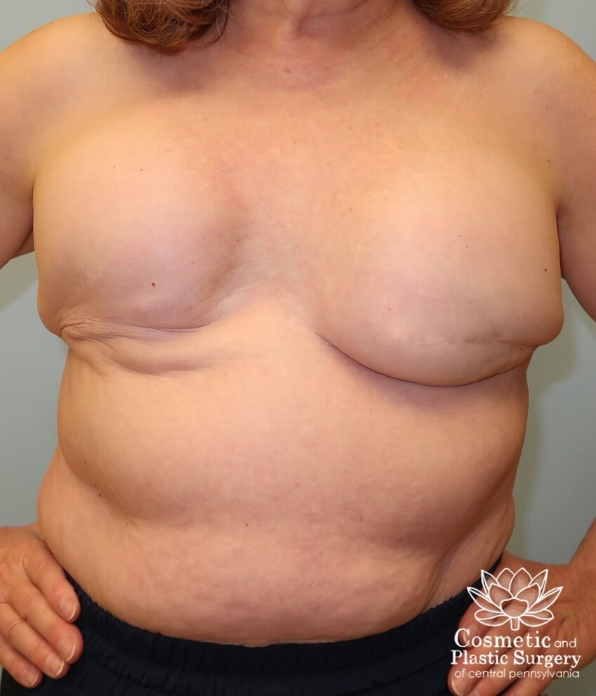 Before Image