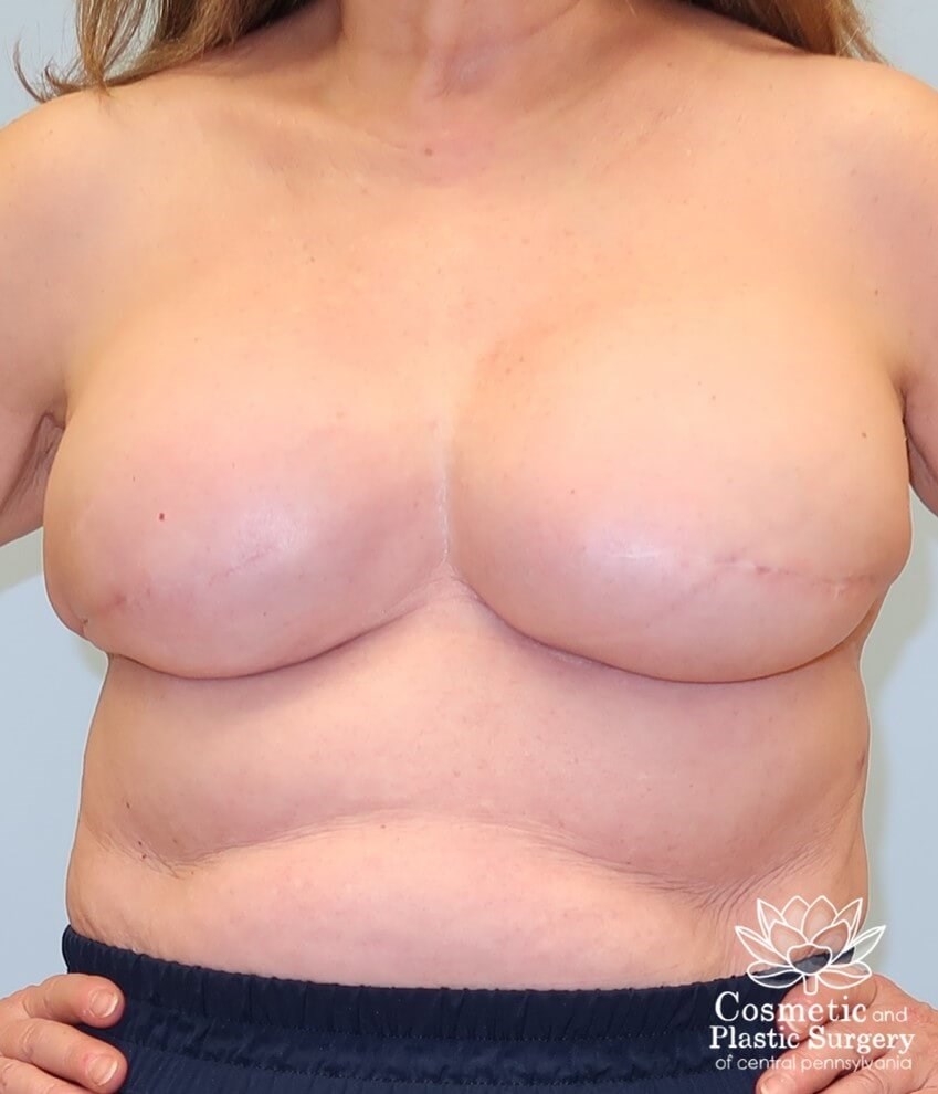 After Image