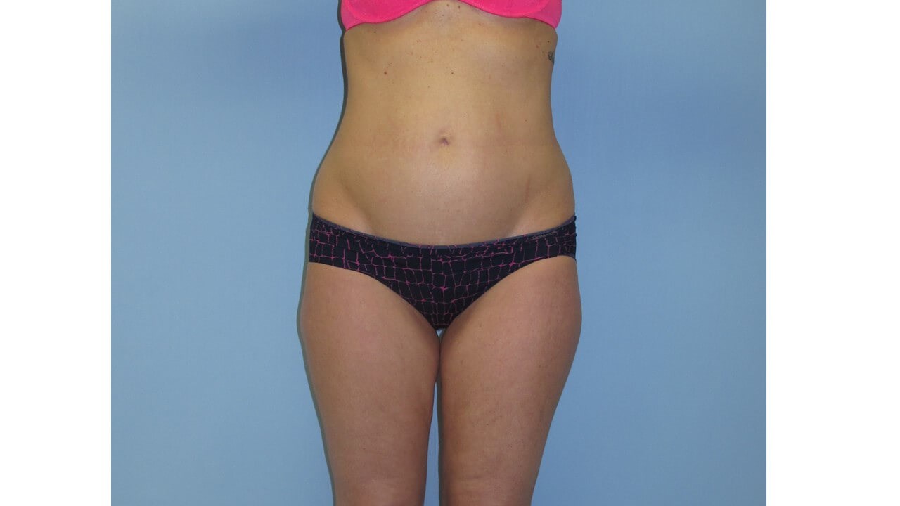 Before Image