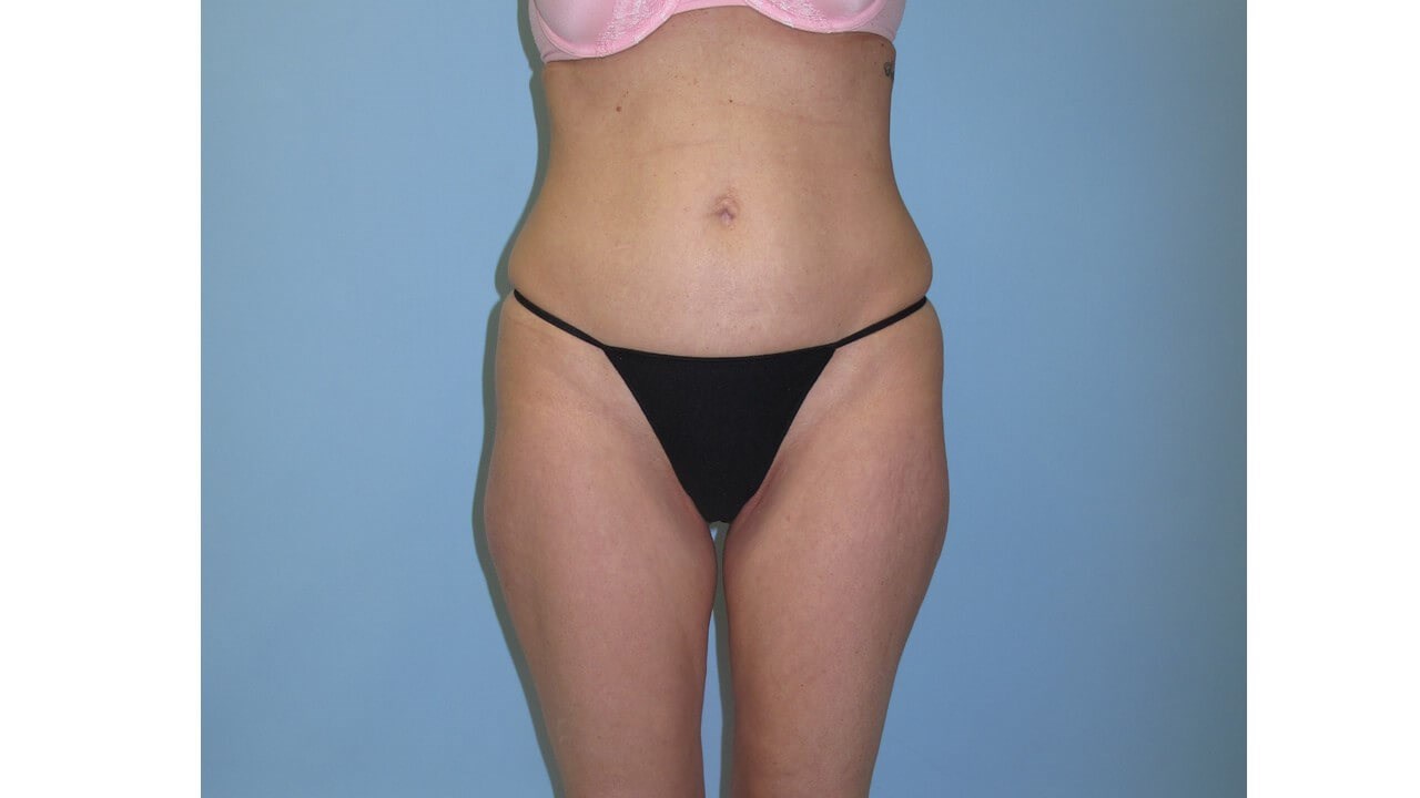 After Image