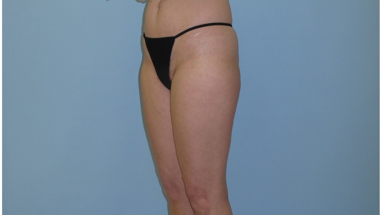 After Image