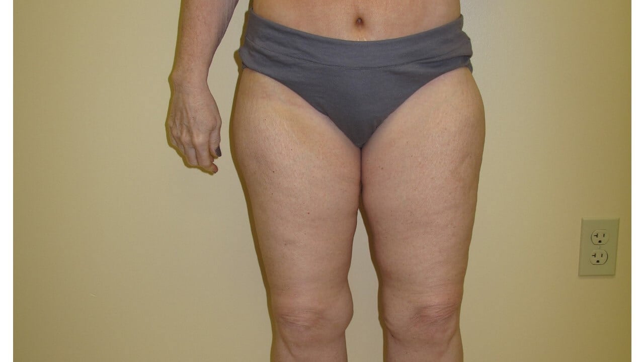 After Image