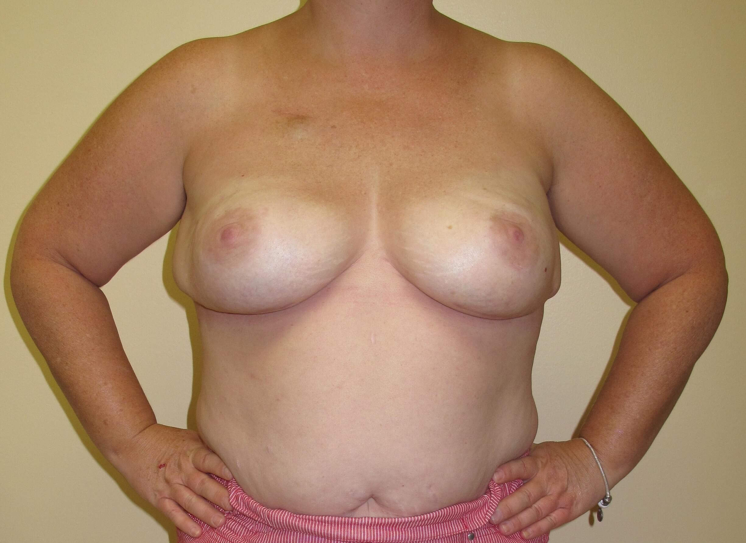 After Image