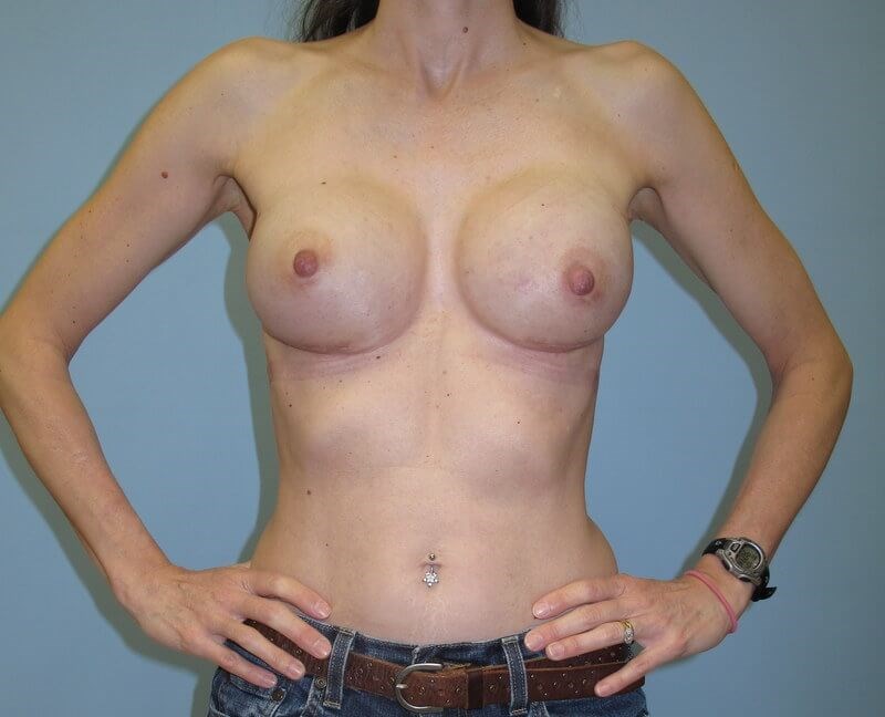 After Image