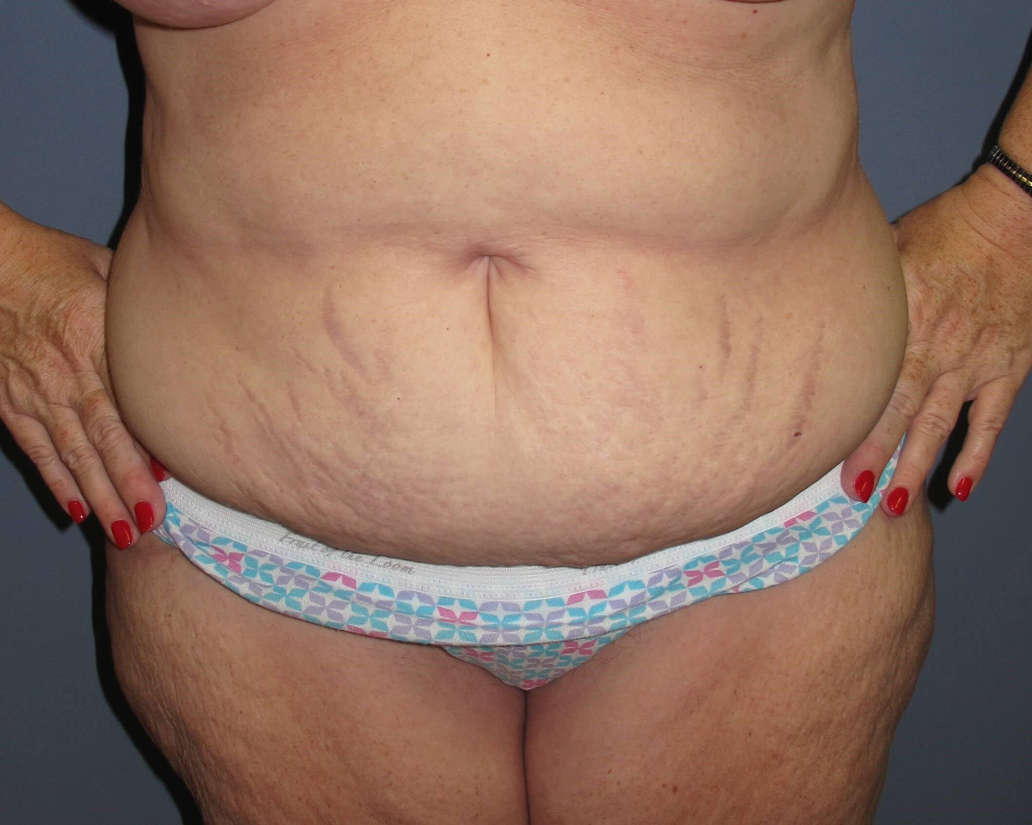 Before Image