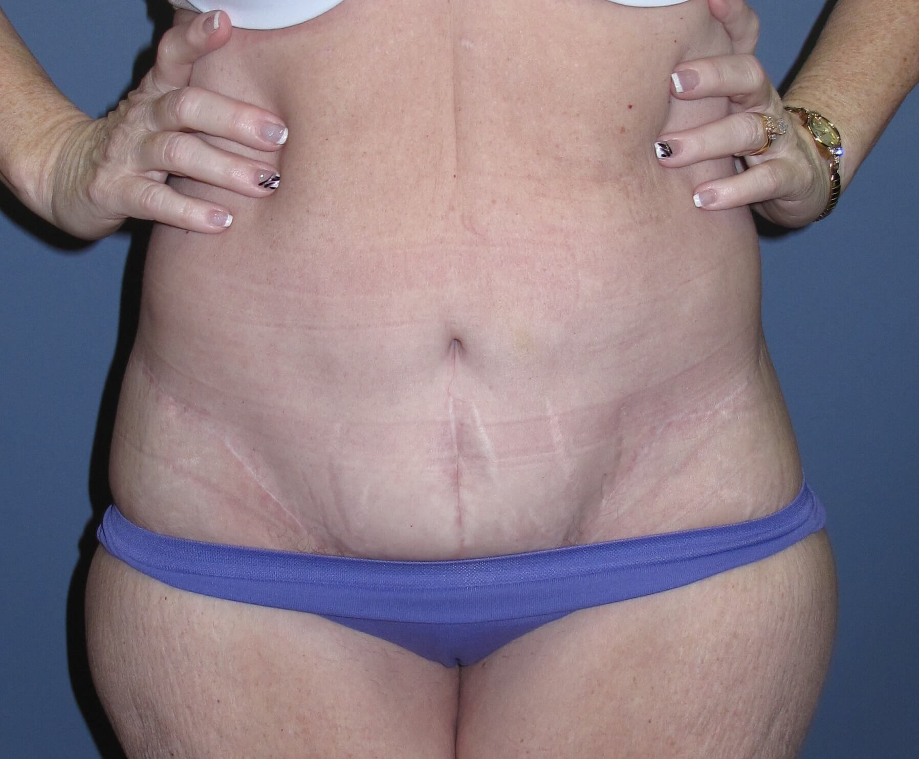 After Image