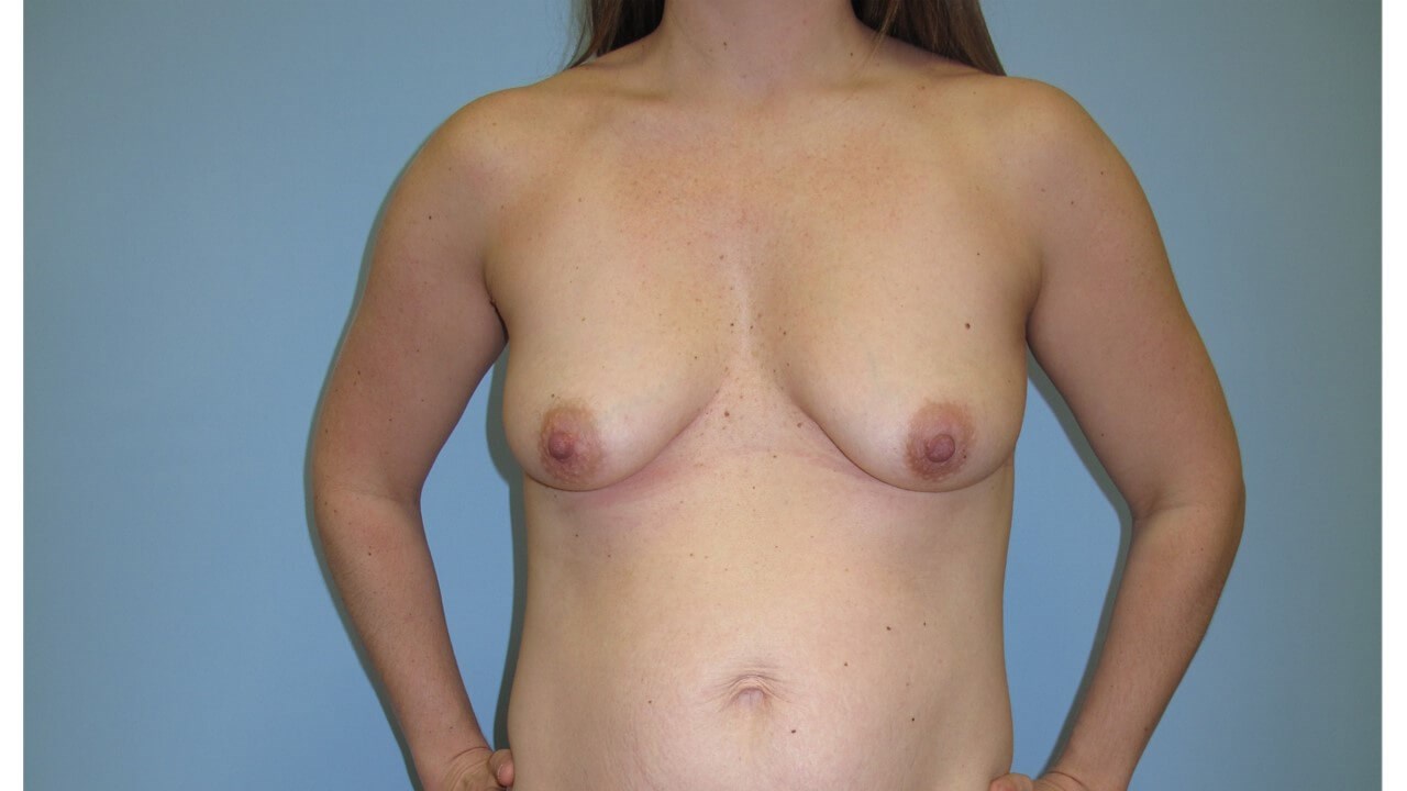 Before Image