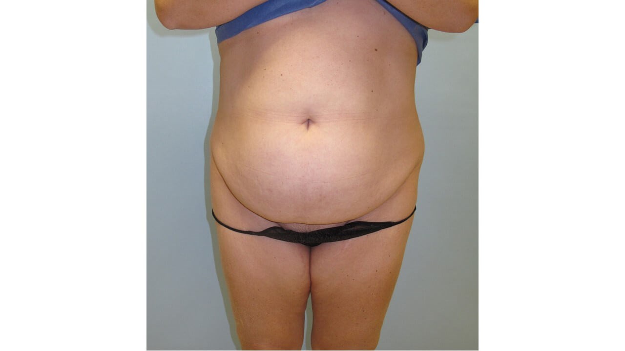 Before Image