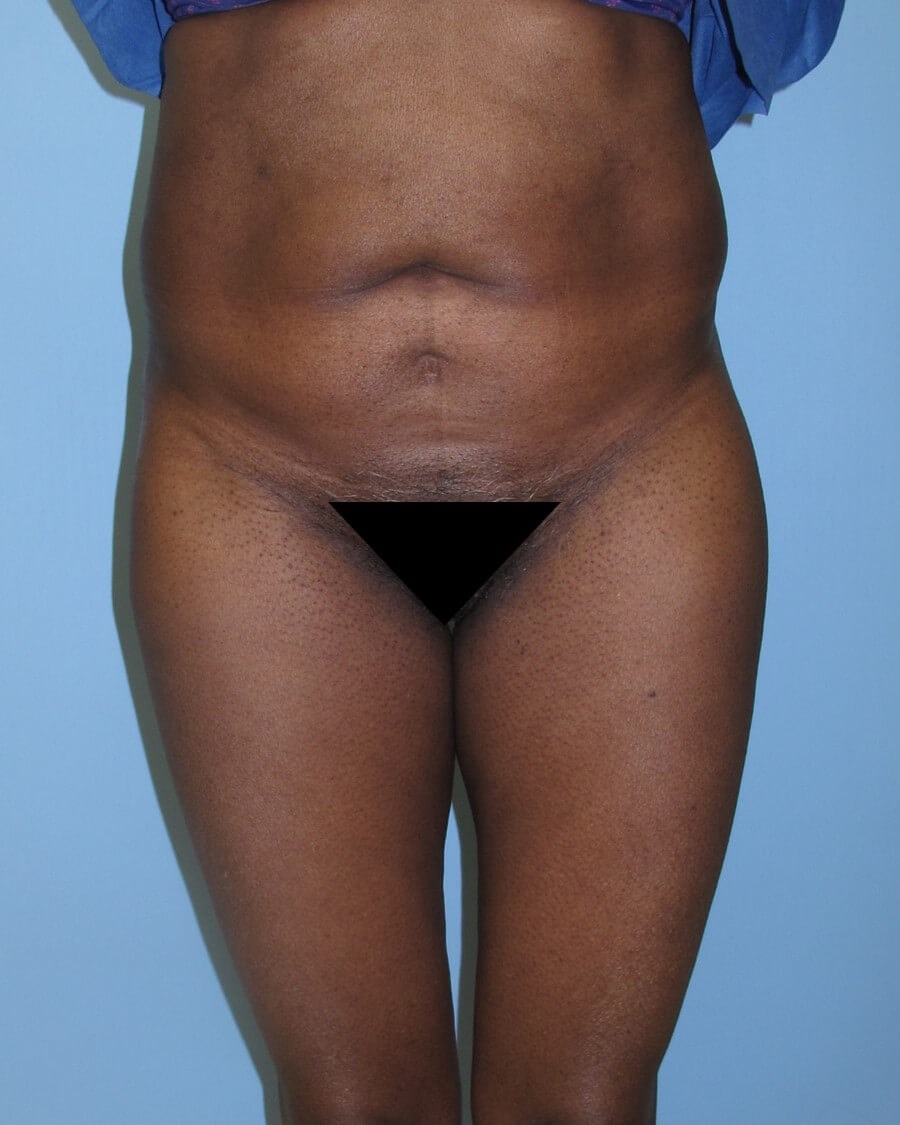 Before Image