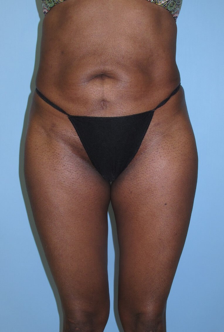 After Image