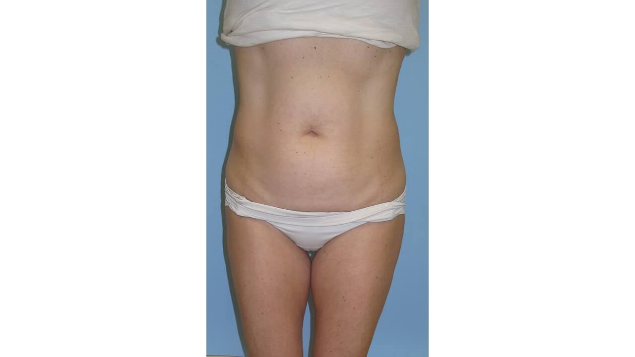 Before Image