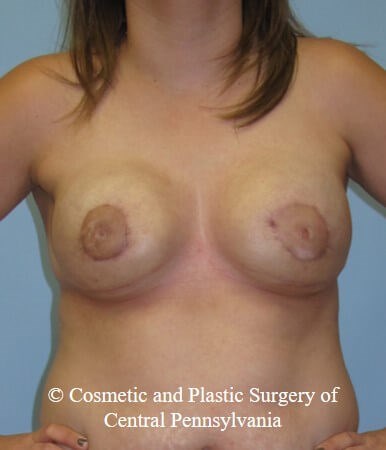 After Image