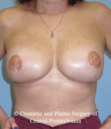 After Image