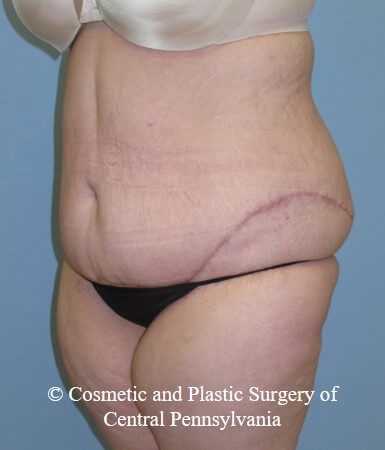 After Image