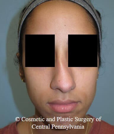 Before Image
