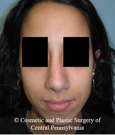 After Image