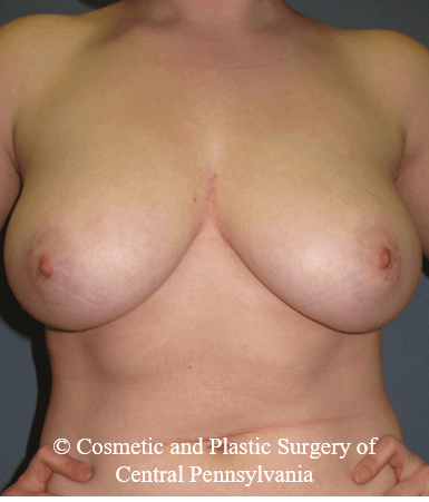 Before Image