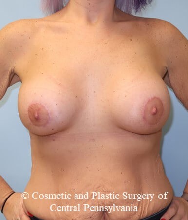 After Image