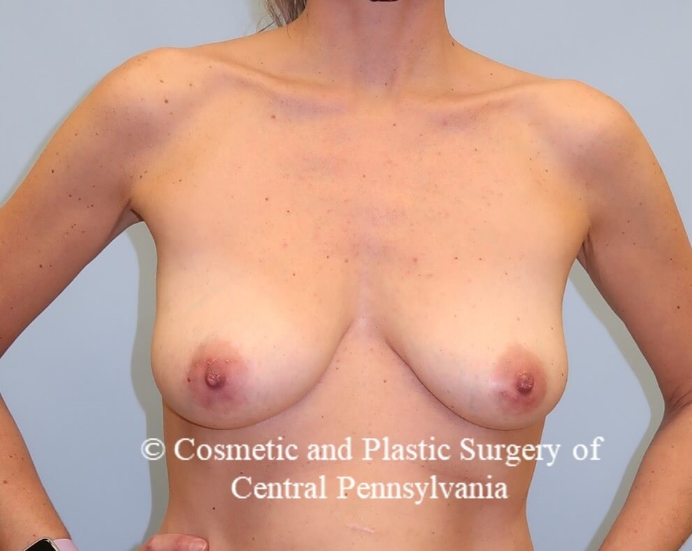 Before Image