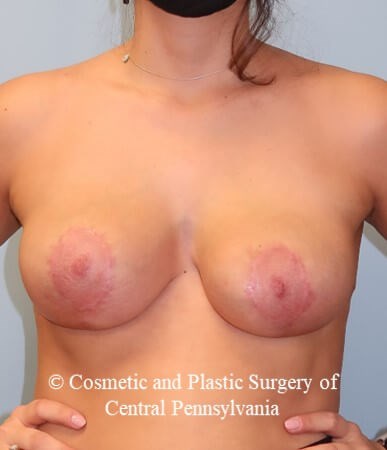 After Image