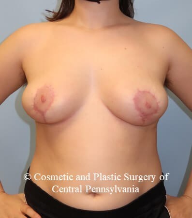 After Image