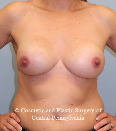 After Image