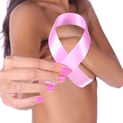 Breast Reconstruction